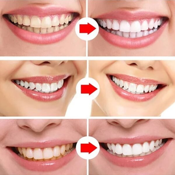 【EELHOEホワイトニングジェル】歯にやさしい、着色除去、歯を白くする、口臭防止、歯垢除去